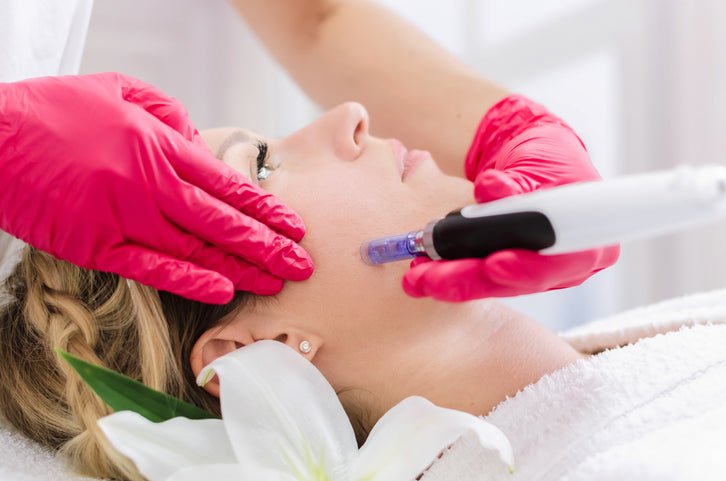 Microneedling with PRP Injections- Full Face